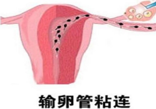 滋肾育胎丸有必要吃吗,早期吃滋肾育胎丸有坏处吗